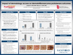 Impact of Dermatology Access on Dermatofibrosarcoma Protuberans Outcomes by Joseph H. Kelly and Marcus L. Frohm